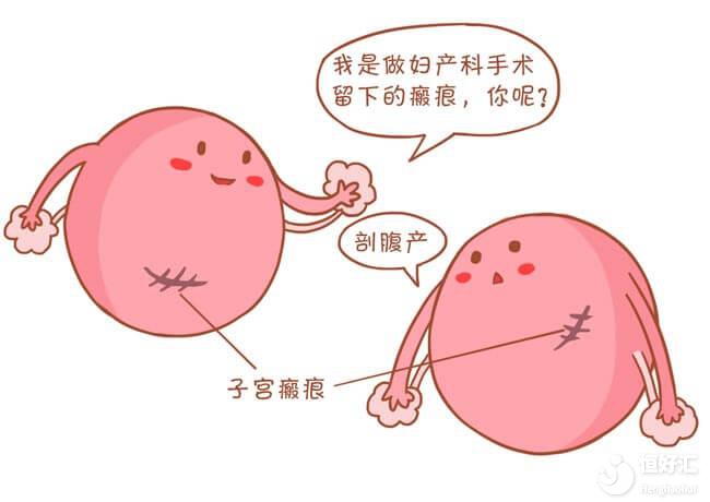 瘢痕子宫是什么？能做试管婴儿吗？